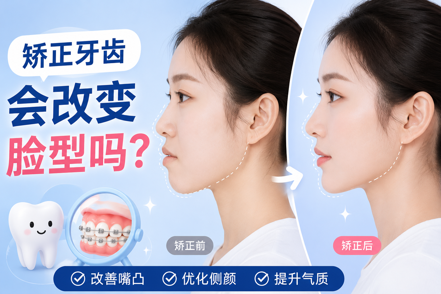 矫正牙齿会改变脸型吗？牙医匠详解正畸与面部轮廓的真实关系