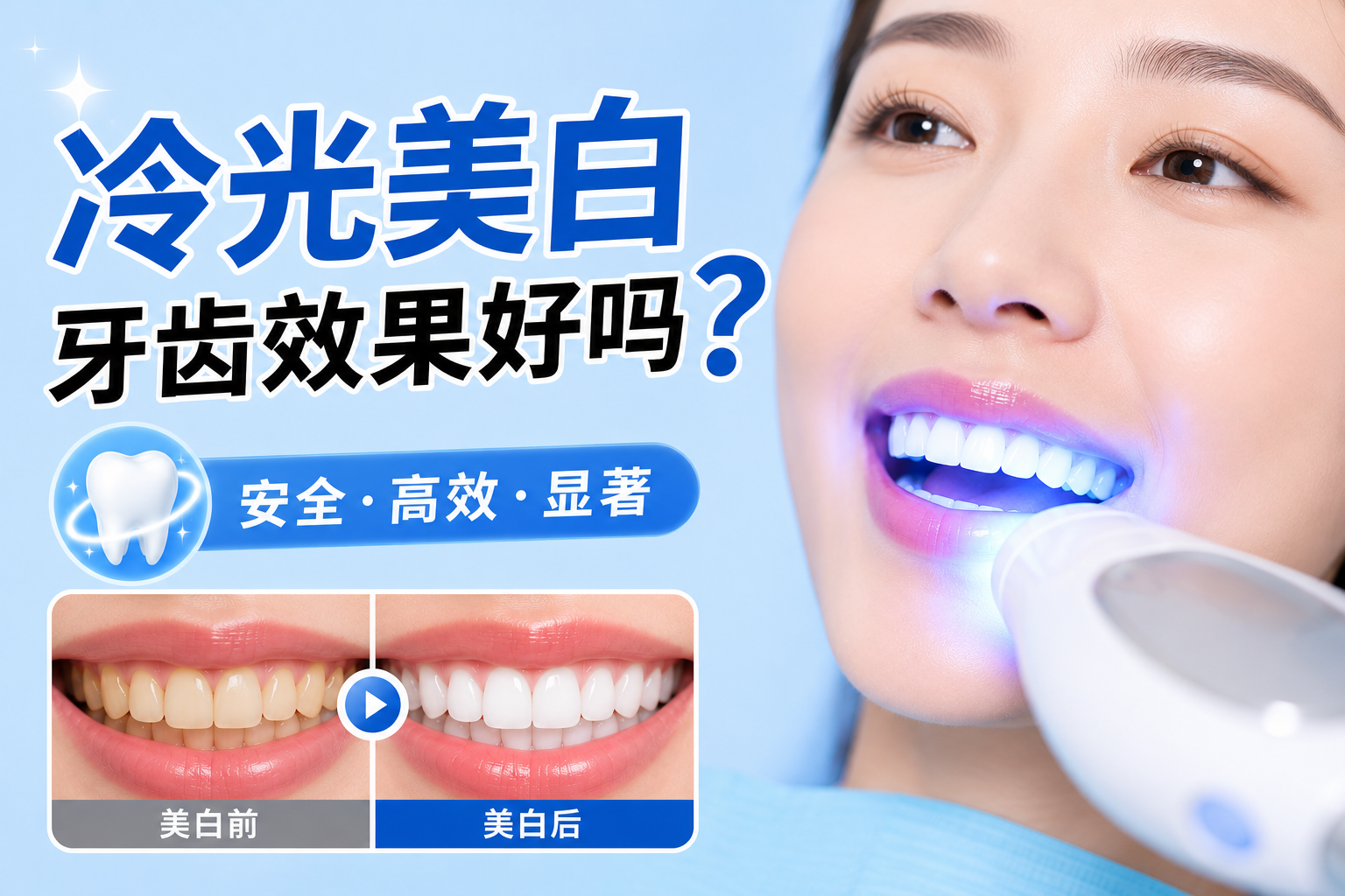 冷光美白牙齿效果好吗?牙医匠揭秘真实美白程度、维持时间及避坑指南