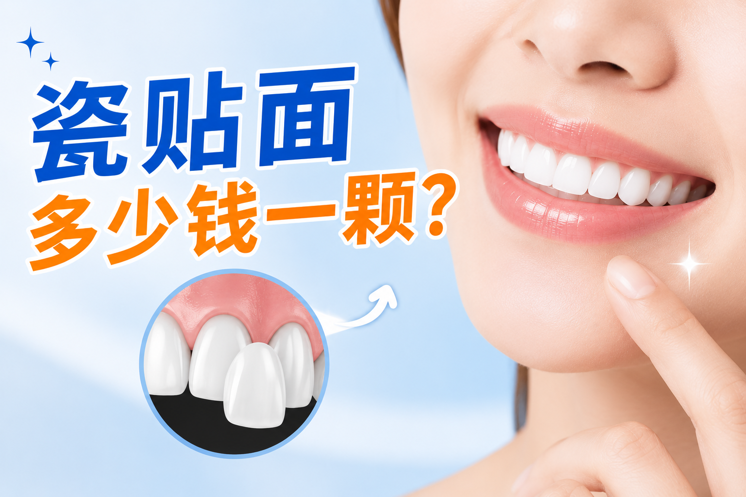 瓷贴面多少钱一颗？牙医匠揭秘避坑指南：别让低价毁了你的真牙