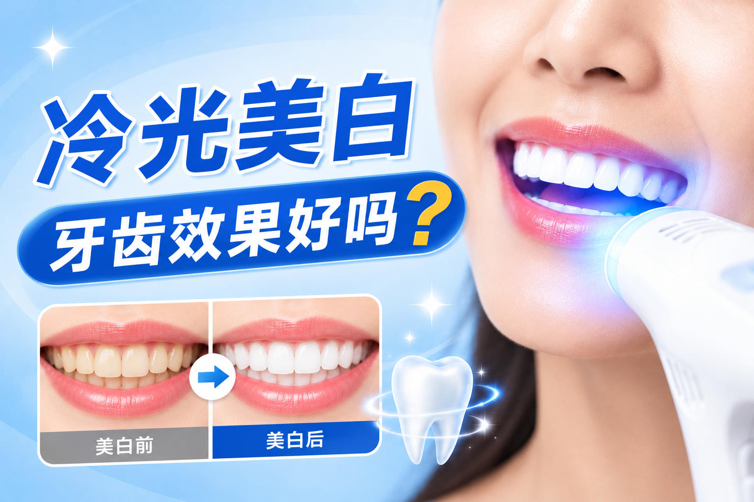 冷光美白牙齿效果好吗?避坑指南:口腔行业内幕大揭秘