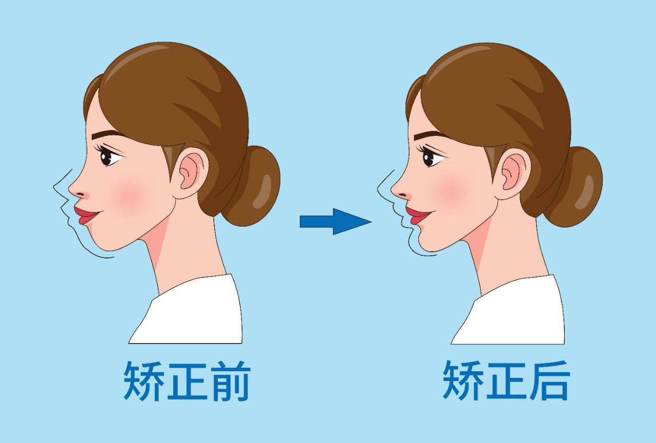 武汉牙齿矫正哪家好真实评价+价格拆解｜武大口腔/同济vs优益佳/德韩，隐适美Full 3.8万起，二次矫正医生推荐