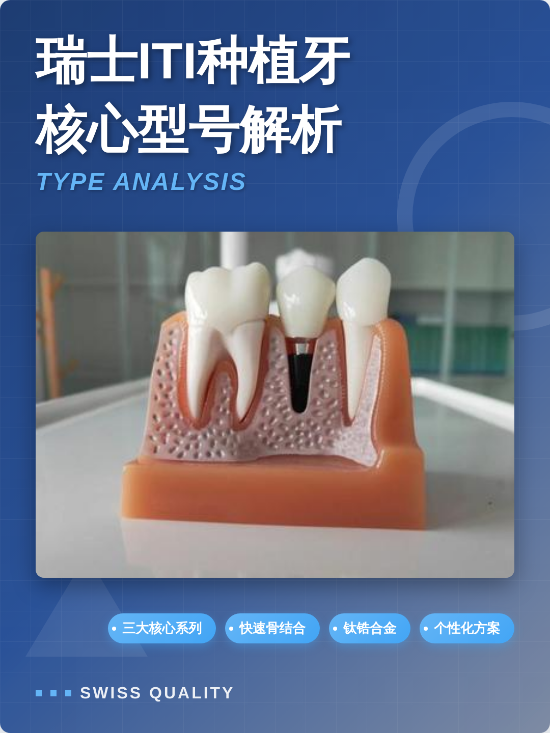 ITI种植牙怎么样?优缺点、价格、适合人群一次看懂