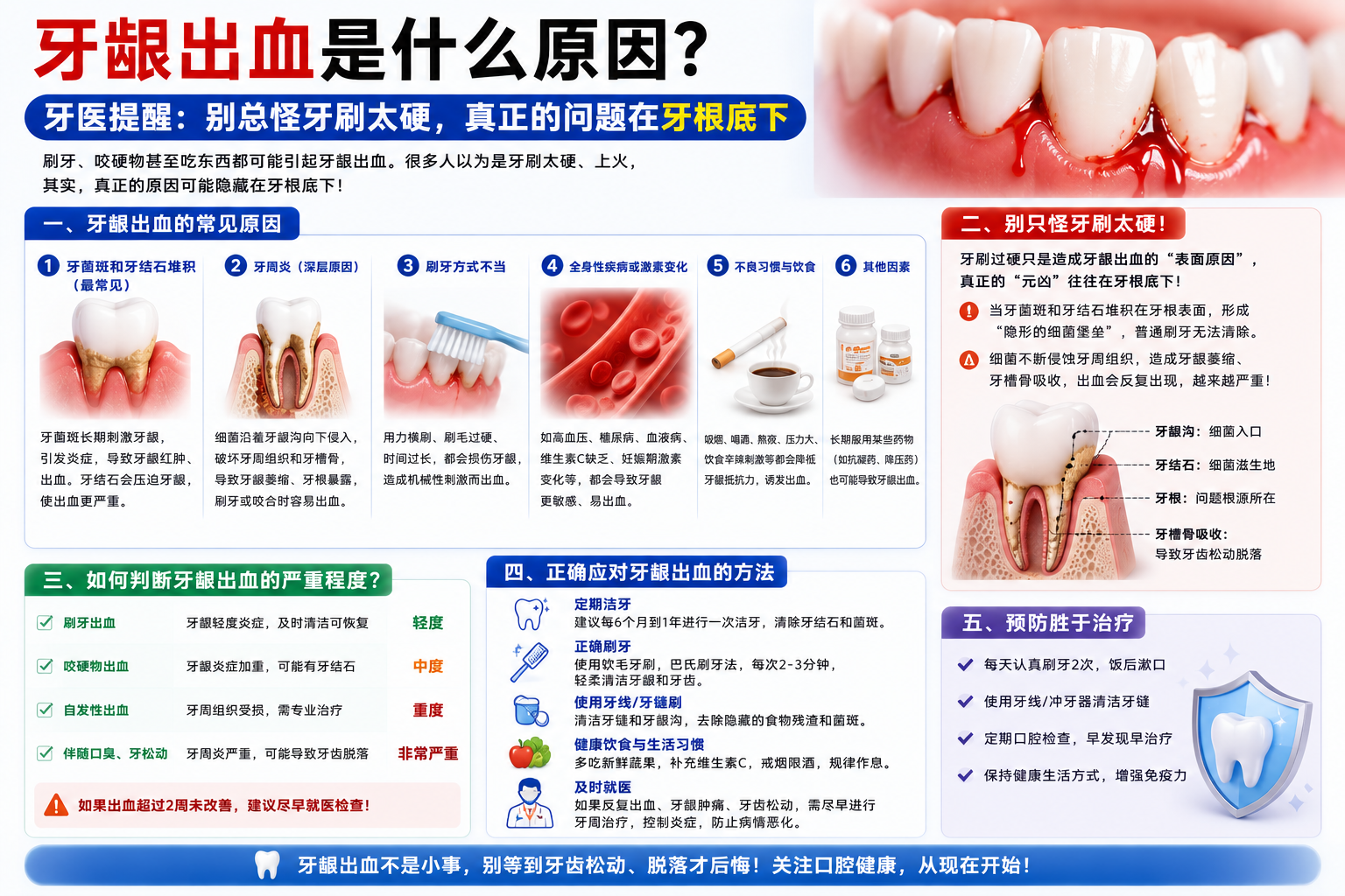 牙龈出血是什么原因？牙医提醒：别总怪牙刷太硬，真正的问题在牙根底下